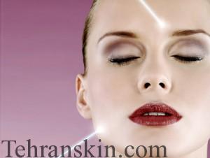 Top-Acne-Laser-Skin-Treatment (1)